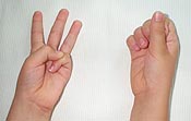 Three fingers