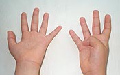 Nine fingers